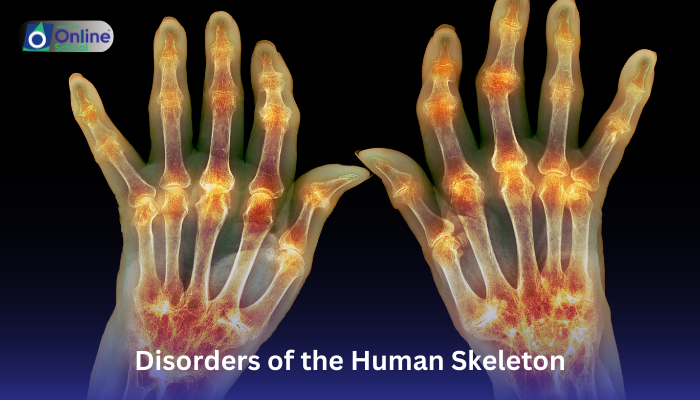 Lesson 06: Disorders of the Human Skeleton
